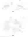 Fig. 02 - Photochemically induced engagement of intraocular implants