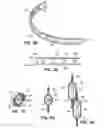 Fig. 07 - Apparatus and methods for implanting a replacement heart valve