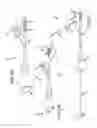 Fig. 03 - Method of fusing a sacroiliac joint with an implant with struts