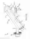 Fig. 101 - Method of fusing a sacroiliac joint with an implant with struts
