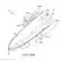 Fig. 102 - Method of fusing a sacroiliac joint with an implant with struts