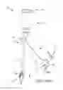 Fig. 105 - Method of fusing a sacroiliac joint with an implant with struts
