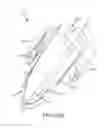 Fig. 108 - Method of fusing a sacroiliac joint with an implant with struts