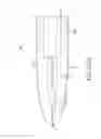 Fig. 110 - Method of fusing a sacroiliac joint with an implant with struts