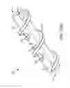 Fig. 112 - Method of fusing a sacroiliac joint with an implant with struts
