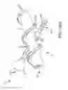 Fig. 114 - Method of fusing a sacroiliac joint with an implant with struts