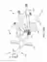 Fig. 119 - Method of fusing a sacroiliac joint with an implant with struts