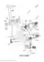 Fig. 120 - Method of fusing a sacroiliac joint with an implant with struts