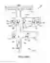 Fig. 121 - Method of fusing a sacroiliac joint with an implant with struts