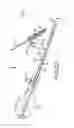 Fig. 14 - Method of fusing a sacroiliac joint with an implant with struts