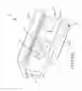 Fig. 141 - Method of fusing a sacroiliac joint with an implant with struts