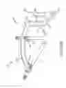 Fig. 149 - Method of fusing a sacroiliac joint with an implant with struts