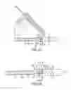 Fig. 15 - Method of fusing a sacroiliac joint with an implant with struts