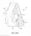 Fig. 174 - Method of fusing a sacroiliac joint with an implant with struts