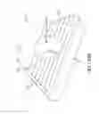 Fig. 175 - Method of fusing a sacroiliac joint with an implant with struts