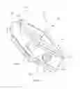 Fig. 191 - Method of fusing a sacroiliac joint with an implant with struts