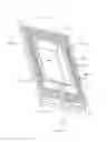 Fig. 192 - Method of fusing a sacroiliac joint with an implant with struts