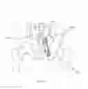 Fig. 216 - Method of fusing a sacroiliac joint with an implant with struts