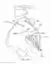 Fig. 217 - Method of fusing a sacroiliac joint with an implant with struts