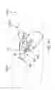 Fig. 218 - Method of fusing a sacroiliac joint with an implant with struts
