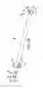 Fig. 22 - Method of fusing a sacroiliac joint with an implant with struts