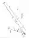 Fig. 26 - Method of fusing a sacroiliac joint with an implant with struts
