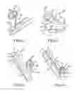 Fig. 28 - Method of fusing a sacroiliac joint with an implant with struts