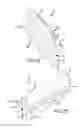 Fig. 38 - Method of fusing a sacroiliac joint with an implant with struts