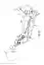 Fig. 43 - Method of fusing a sacroiliac joint with an implant with struts