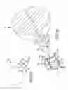 Fig. 45 - Method of fusing a sacroiliac joint with an implant with struts