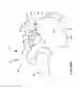 Fig. 51 - Method of fusing a sacroiliac joint with an implant with struts