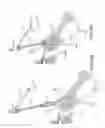 Fig. 60 - Method of fusing a sacroiliac joint with an implant with struts