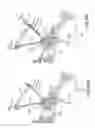 Fig. 61 - Method of fusing a sacroiliac joint with an implant with struts