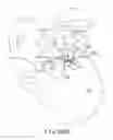 Fig. 79 - Method of fusing a sacroiliac joint with an implant with struts