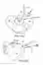Fig. 83 - Method of fusing a sacroiliac joint with an implant with struts