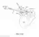 Fig. 84 - Method of fusing a sacroiliac joint with an implant with struts