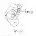 Fig. 85 - Method of fusing a sacroiliac joint with an implant with struts