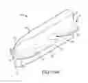 Fig. 93 - Method of fusing a sacroiliac joint with an implant with struts