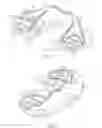 Fig. 02 - Cruciate-retaining knee prosthesis