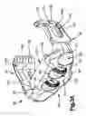 Fig. 06 - Intervertebral implants, systems, and methods of use