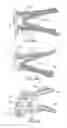 Fig. 09 - Lateral block plate