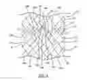 Fig. 03 - Woven stent device and manufacturing method