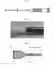 Fig. 02 - Systems and methods for percutaneous removal of objects from an internal body space