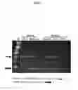 Fig. 02 - Polynucleotides encoding methylmalonyl-CoA mutase