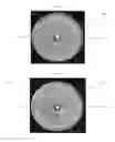 Fig. 02 - CALCIUM BASED CLINICAL MATERIAL WITH ANTIMICROBIAL PROPERTIES AND METHOD OF FORMING FOR PREVENTION OR TREATMENT OF INFECTION