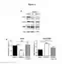 Fig. 02 - TRICYCLIC DIBENZOTHIAZEPINE TYPE COMPOUNDS FOR USE IN THE THERAPY OF CDKL5 DISORDER