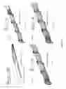 Fig. 33 - INTRAMUSCULAR ADMINISTRATON OF AUTOLOGOUS BONE MARROW FOR TREATMENT