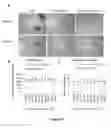 Fig. 50 - INTRAMUSCULAR ADMINISTRATON OF AUTOLOGOUS BONE MARROW FOR TREATMENT