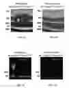 Fig. 02 - Methods for modulating development and function of photoreceptor cells