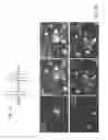 Fig. 02 - Neurotherapeutic nanoparticle compositions comprising leukemia inhibitory factor